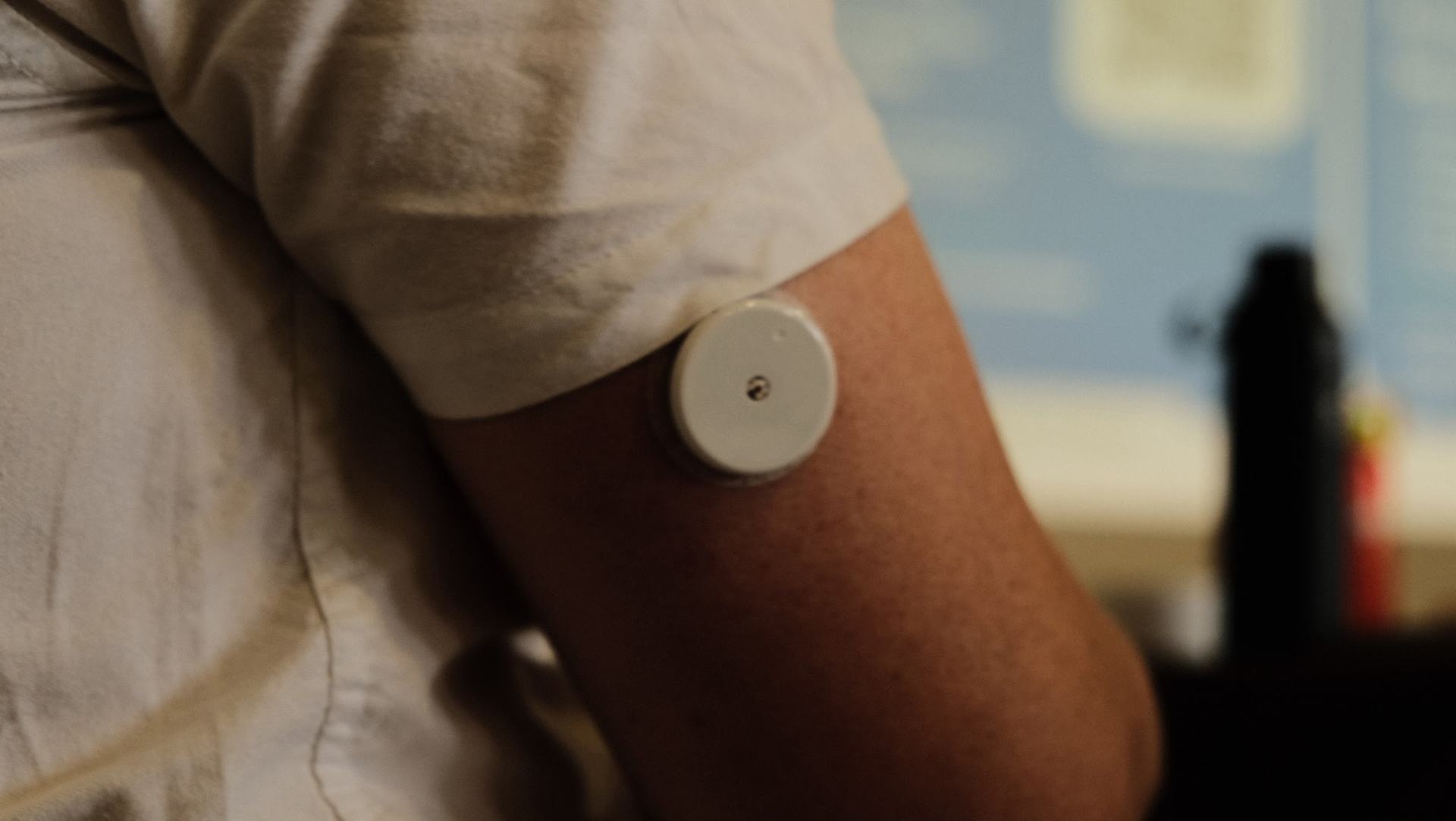 A person wearing a CGM sensor on the back of their upper arm